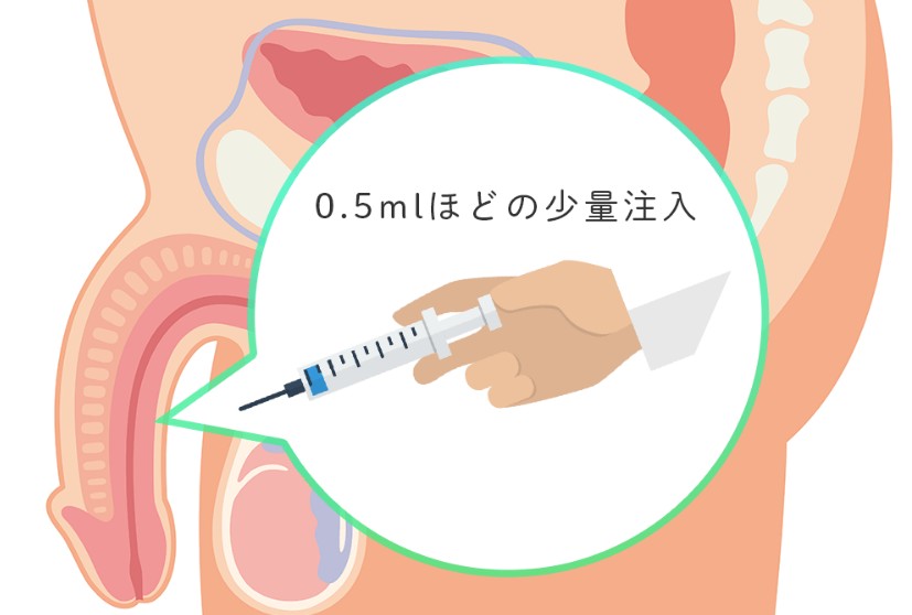 海綿體注射治療